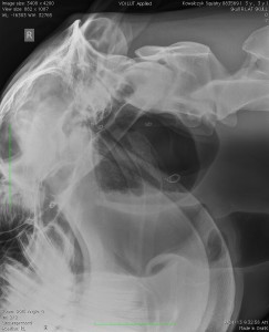 An x-ray of Squish's guttural pouch where four coils were inserted to block blood flow to his carotid artery. Photo provided by Emily Kowalcyzk.