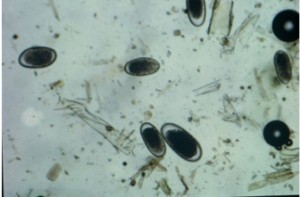 Eggs produced by adult female strongyles and passed in the stool of a horse. Photo provided by Horsemen's Laboratory.