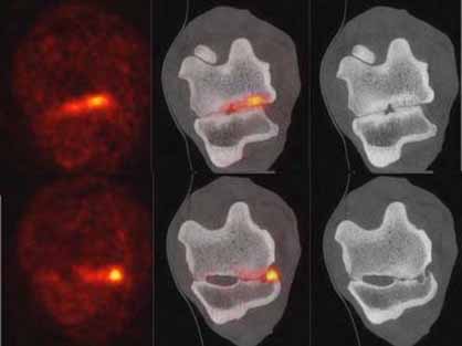 Precise Imaging Solves Quarter Horse’s Chronic Lameness Issue