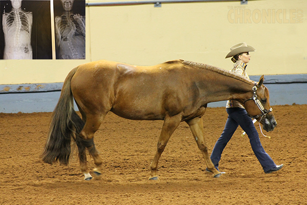 Overcoming Odds- Showmanship After Scoliosis Surgery