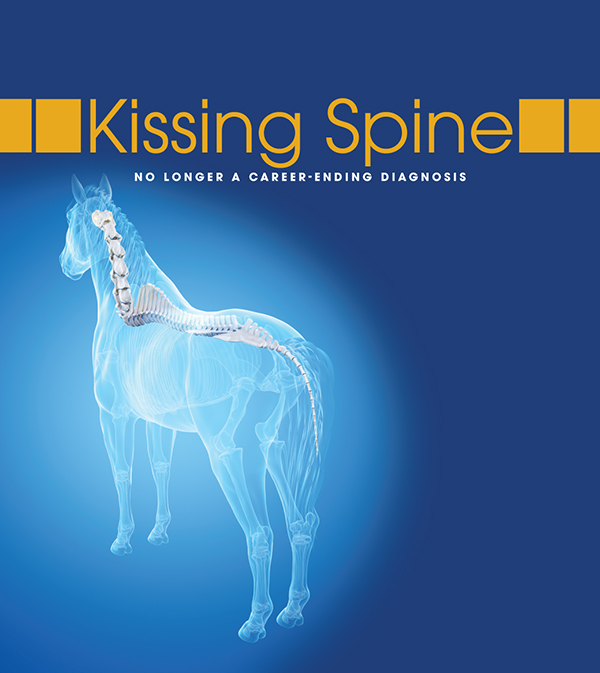Kissing Spine: No Longer a Career Ending Diagnosis