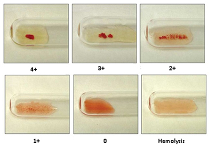 Do You Know Your Horse’s Blood Type? A, C, D, K, P, Q, or U?